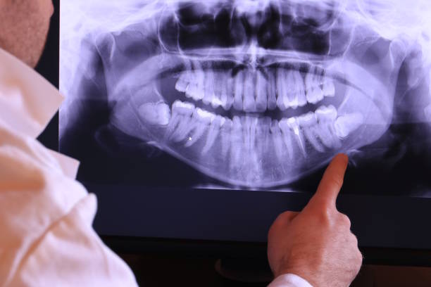 Best Emergency Dental Care for Broken or Chipped Teeth in Borden, IN