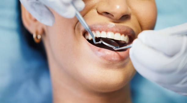 Best Urgent Care for Lost Fillings or Crowns in Borden, IN