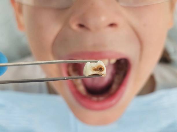 Best Pediatric Emergency Dentist in Borden, IN